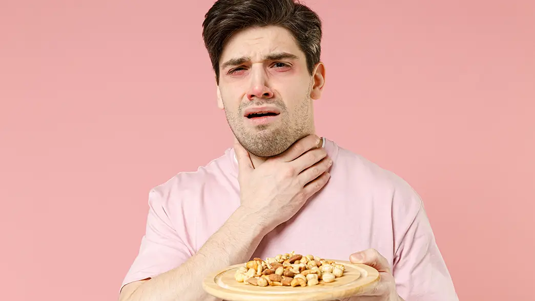 Die Symptome von Nahrungsmittelallergien betreffen häufig die Mundschleimhäute und können sich auch auf die Atemwege auswirken Ein Mann mit Erdnussallergie hat nach dem Essen einiger Nüsse allergische Symptome mit geröteten Augen und Atemnot – er greift sich an den Hals