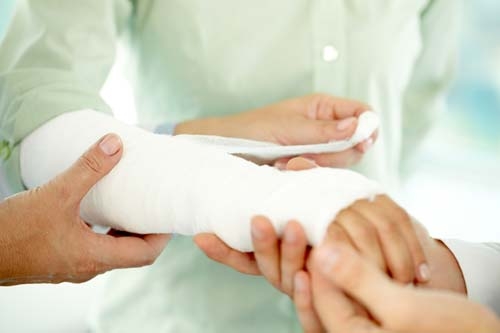 Gipsbinde in Anwendung Gipsbinde wird am Arm angelegt