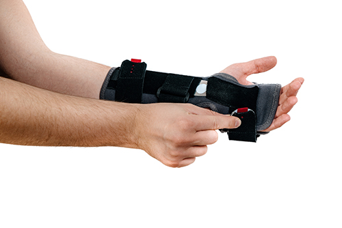 Handorthese wird angelegt handorthese