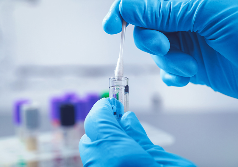 Medizinsche Wattestäbchen Eine Person nutzt medizinische Wattestäbchen
