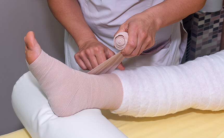 Kompressionsbandagen werden beim Lipödem zur manuellen Lymphdrainage angelegt Anlegen einer Kompressionsbandage