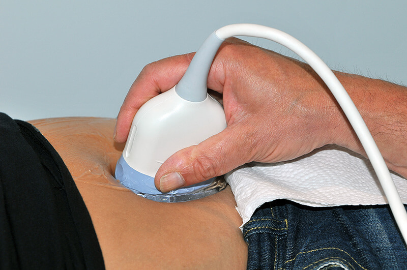  Eine Person nutzt das Ultraschallgel aus einem 5 l Kanister