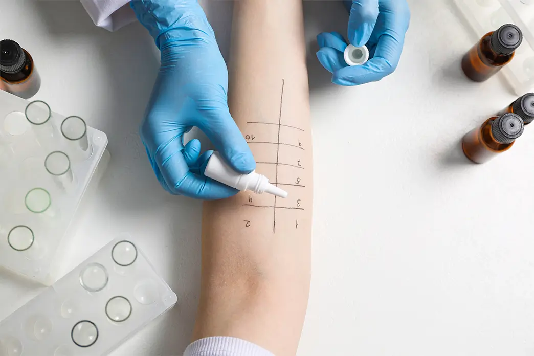 Allergologen haben immer mehr Patienten, weil die Zahl der Allergiker steigt Die Praxen der Allergologen füllen sich von Generation zu Generation mehr