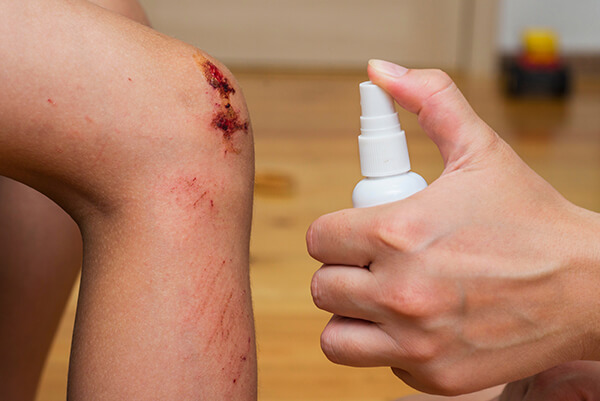 Eine Person sprüht ein verletztes Knie mit schülke Wunddesinfektion ein