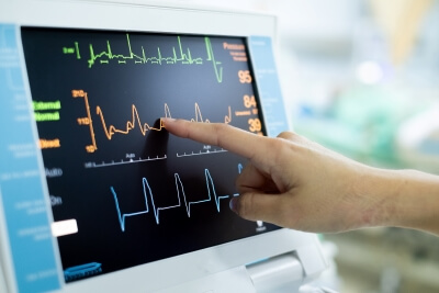 Finger zeigt auf stationäres EKG-Gerät