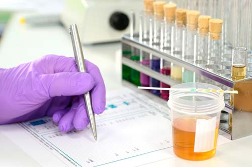 Drogentest Labor Drogentest Labor