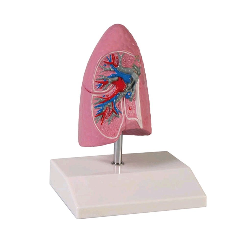 Modell einer Lungenhälfte von Erler Zimmer, 1/2 natürliche Größe