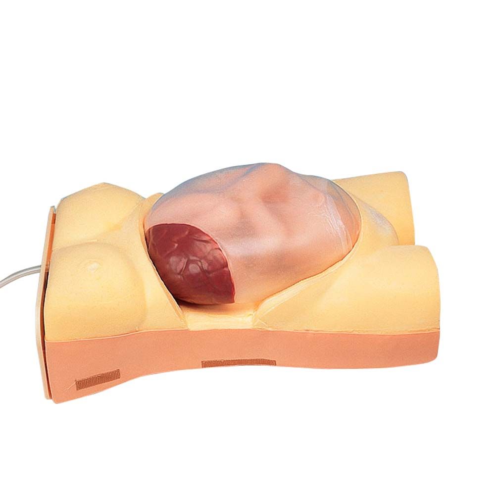 Erler Zimmer Modell - Schwangerschaftsuntersuchung/Herzton-Simulation