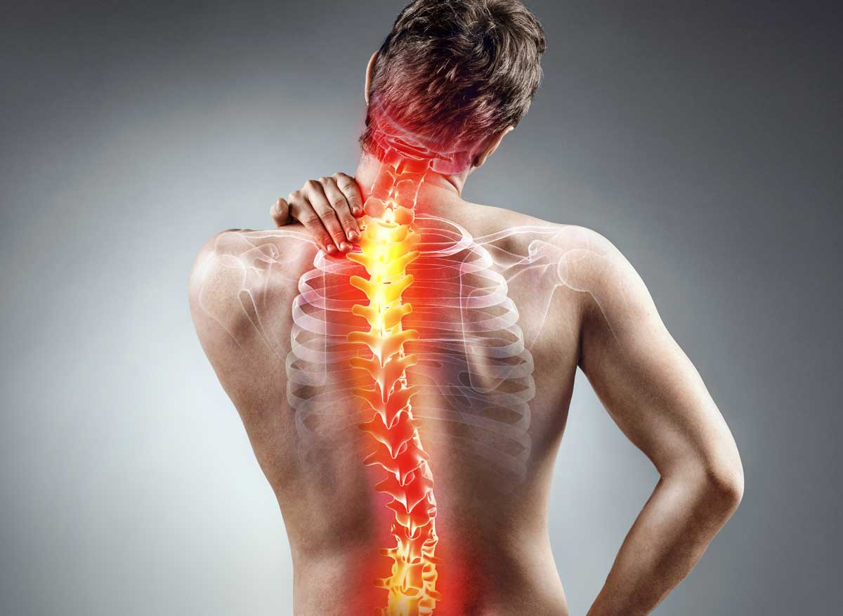 Entzündungen im Rücken sind schmerzhaft, aber nicht immer leicht zu erkennen