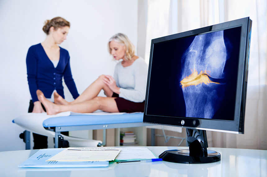 Die Diagnose von Arthrose wird oft erst durch Röntgenbilder, CT oder MRT bestätigt Gonarthrose auf dem Röntgenbild